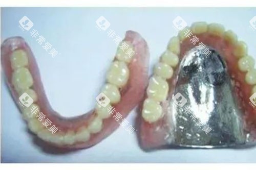 纯钛活动义齿 纯钛活动义齿