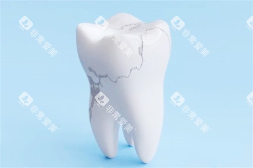 牙隐裂漫画图 牙隐裂漫画图