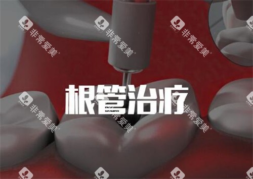 根管治疗卡通图 根管治疗卡通图