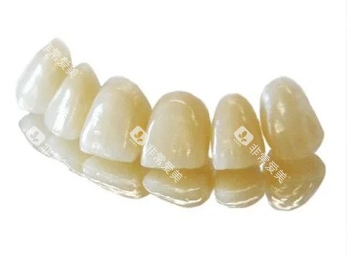 lava全瓷牙牙冠 lava全瓷牙牙冠