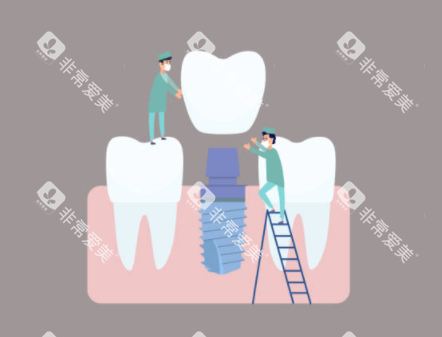 种植牙检查示意图 种植牙检查示意图