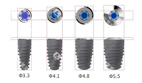卡尔斯种植牙植体型号