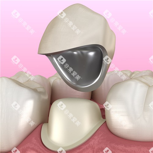 烤瓷牙动漫素材