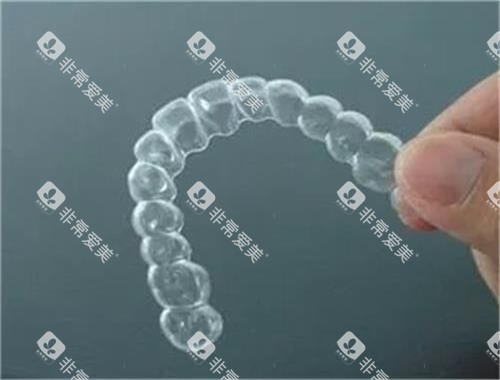 隐形牙齿矫正器示意图 隐形牙齿矫正器示意图