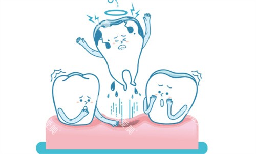 拔牙图片 拔牙图片