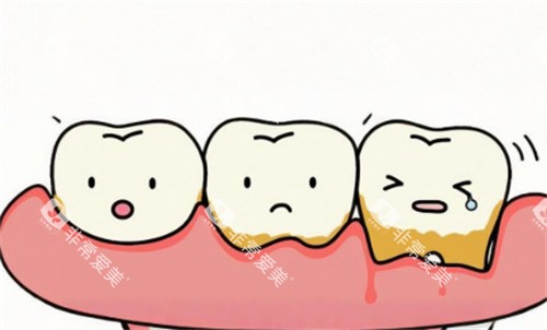 牙周炎动画图 牙周炎动画图