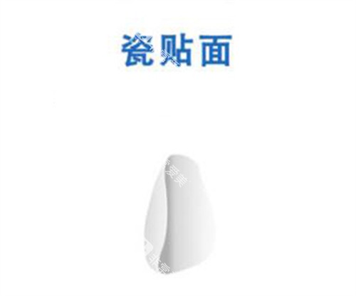 瓷贴面修复改善图