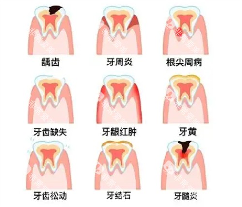 不同牙齿问题