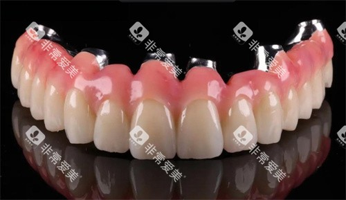 马龙桥种植牙技术