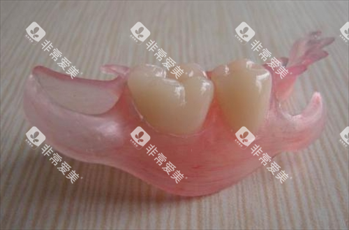 两颗活动假牙示意图