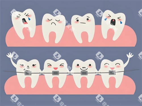 牙齿矫正卡通展示 牙齿矫正卡通展示