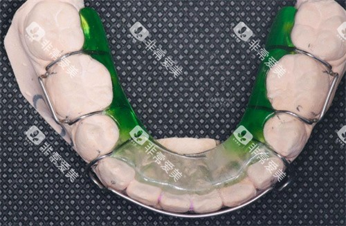 保持器实拍 保持器实拍