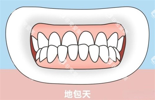 地包天正面演示动画图 地包天正面演示动画图