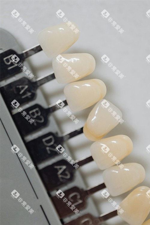 全瓷牙色号