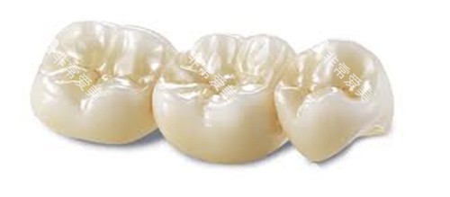 威兰德全瓷牙 威兰德全瓷牙