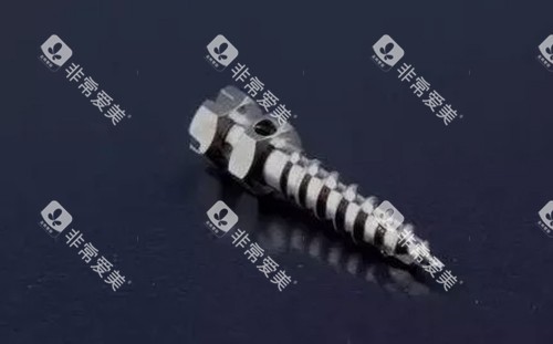正畸支抗钉的图片