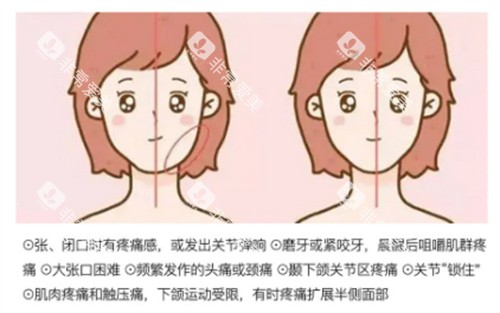 颞下颌关节紊乱出现的大小脸