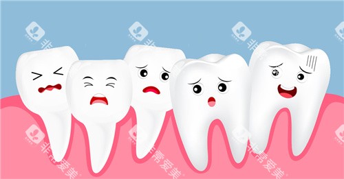 牙齿拥挤动画图