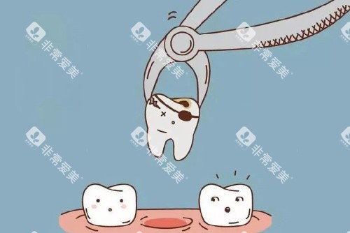 牙齿种植拔牙卡通示意图