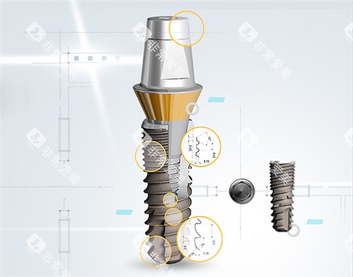 登特斯种植牙植体表面和基台设计放大 登特斯种植牙植体表面和基台设计放大
