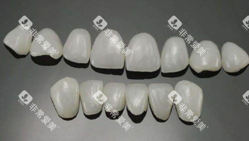 不同尺寸的牙齿贴片 不同尺寸的牙齿贴片