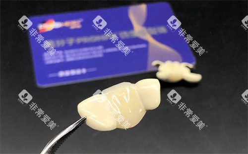 PROHPP聚合瓷粘接桥 PROHPP聚合瓷粘接桥