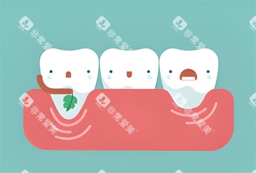 牙龈萎缩卡通示图 牙龈萎缩卡通示图