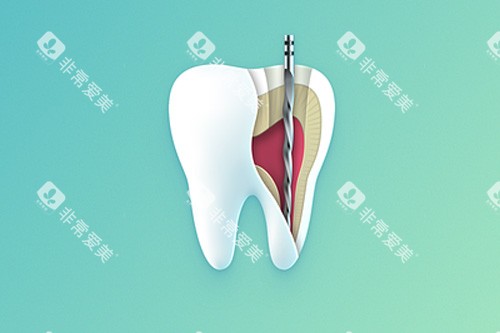 牙齿内部示意图 牙齿内部示意图