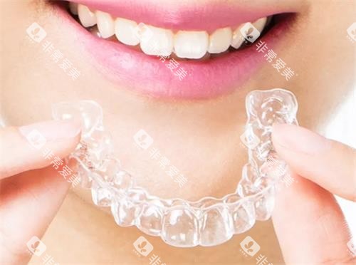 隐形矫正器图示