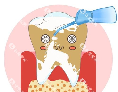 洗牙的动漫示意图