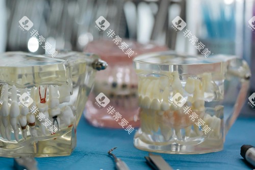 牙齿模型展示图片