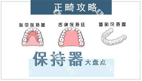 牙齿矫正保持器