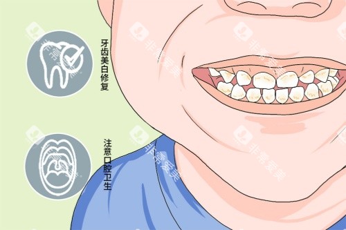 四环素牙卡通图