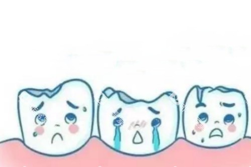 牙齿缺损卡通展示图