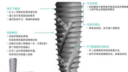 韩国柯威尔种植牙介绍