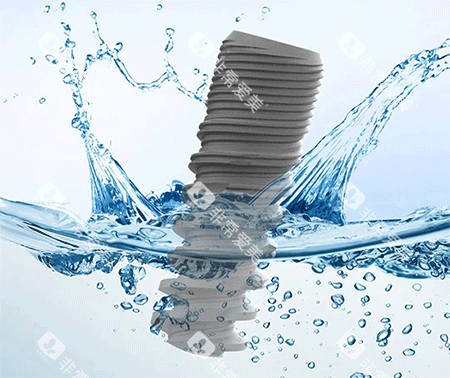 科惠种植牙怎么样 科惠种植牙怎么样