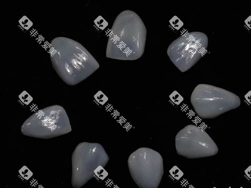 牙齿贴面照片 牙齿贴面照片