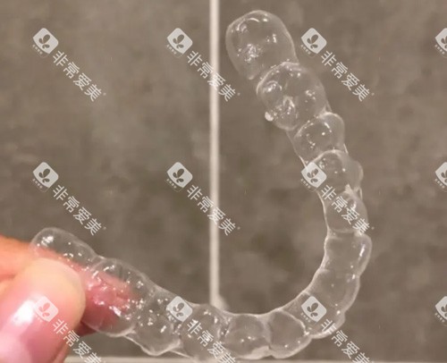 隐形牙齿矫正器