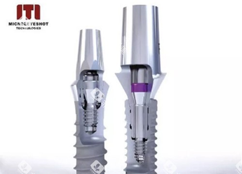 瑞士ITI种植体示意图1