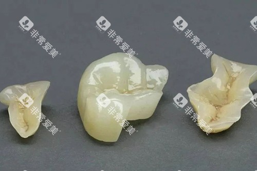补牙部分实物
