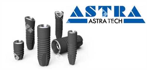 AstraTech种植牙