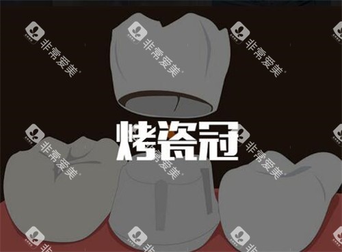 烤瓷牙改善图照片