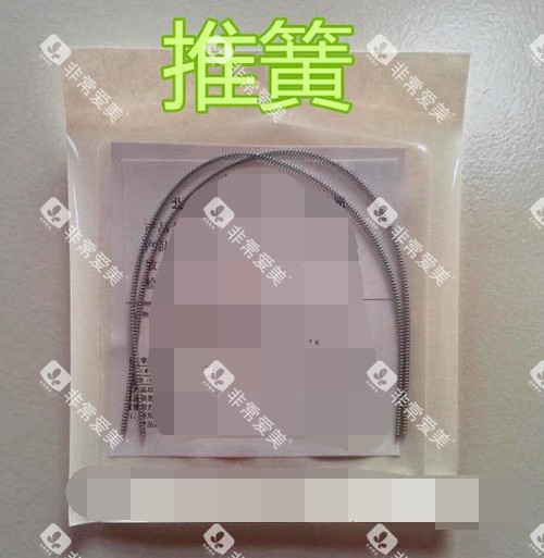 牙齿矫正正畸推簧材料