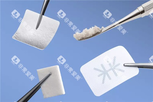 种植牙植骨材料