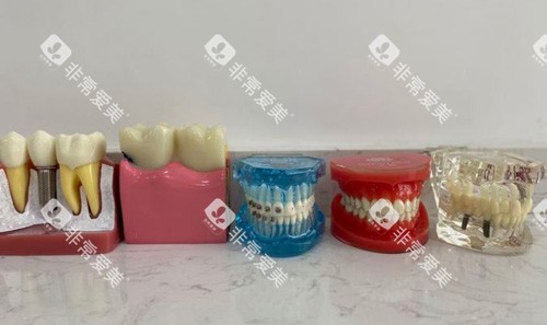 牙齿各种模具图