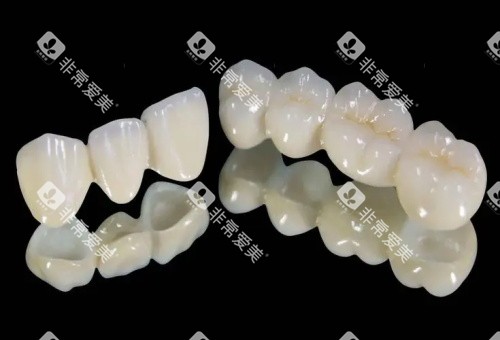 国产爱尔创全瓷牙