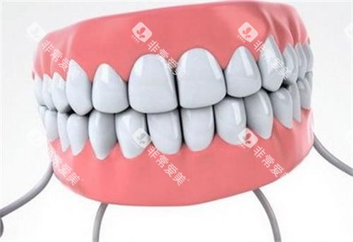 全瓷牙素材