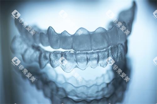 全隐形牙套示意图 全隐形牙套示意图