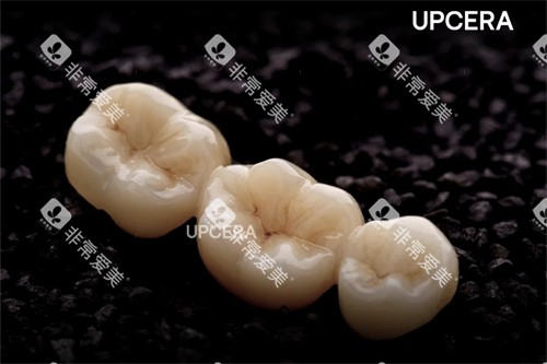 爱尔创-瓷倍健全瓷冠 爱尔创-瓷倍健全瓷冠