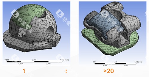 牙齿矫正OBrace球面托槽对比方形托槽